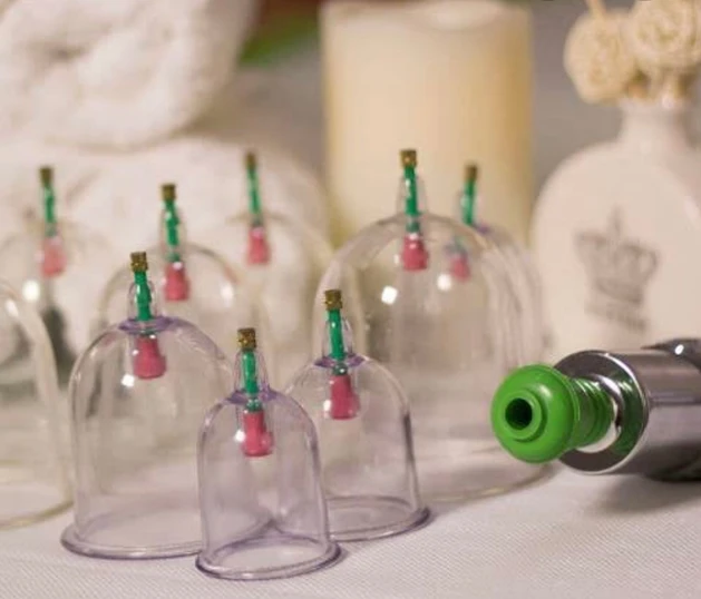 Hijama cupping therapy