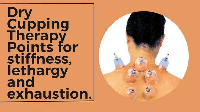 Dry cupping points for stiffness, lethargy and exhaustion.