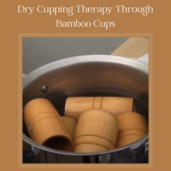 Dry Cupping Therapy Through Bamboo Cups