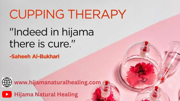 Hijama Cupping Therapy