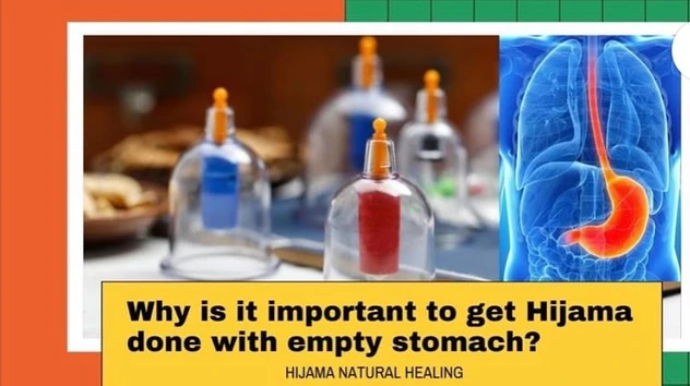 Empty stomach Hijama