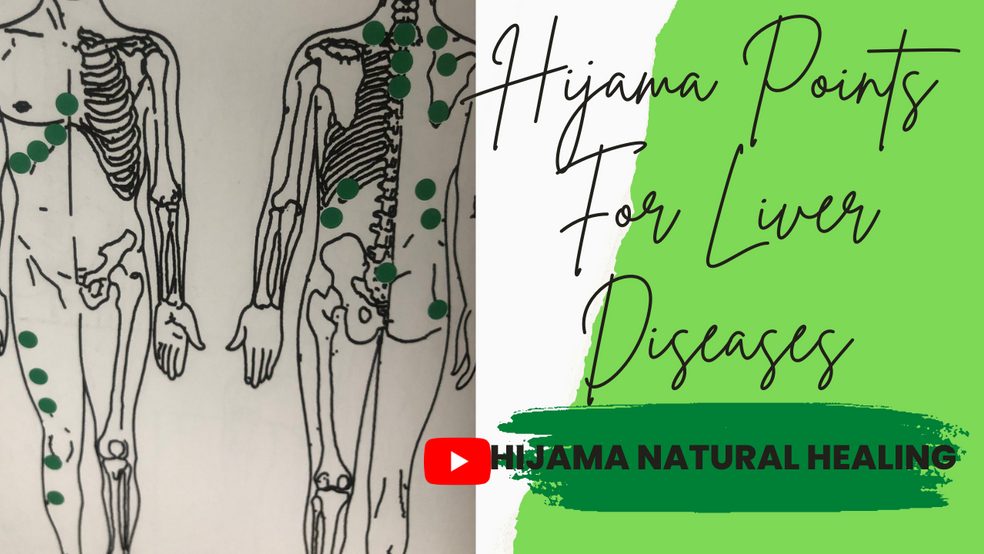 Hijama points for several liver diseases