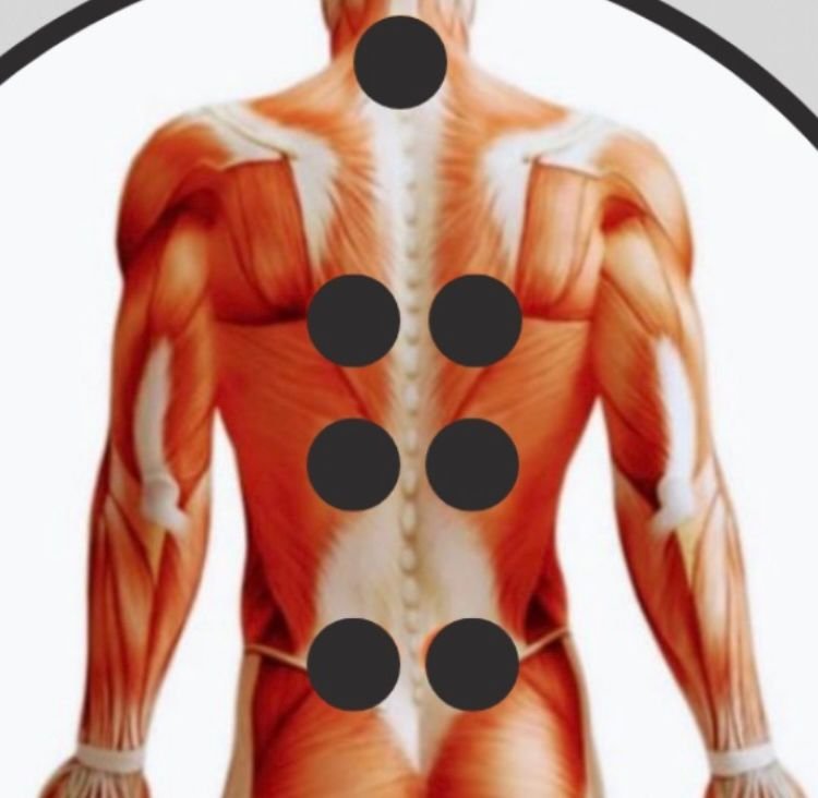 7 organ hijama points