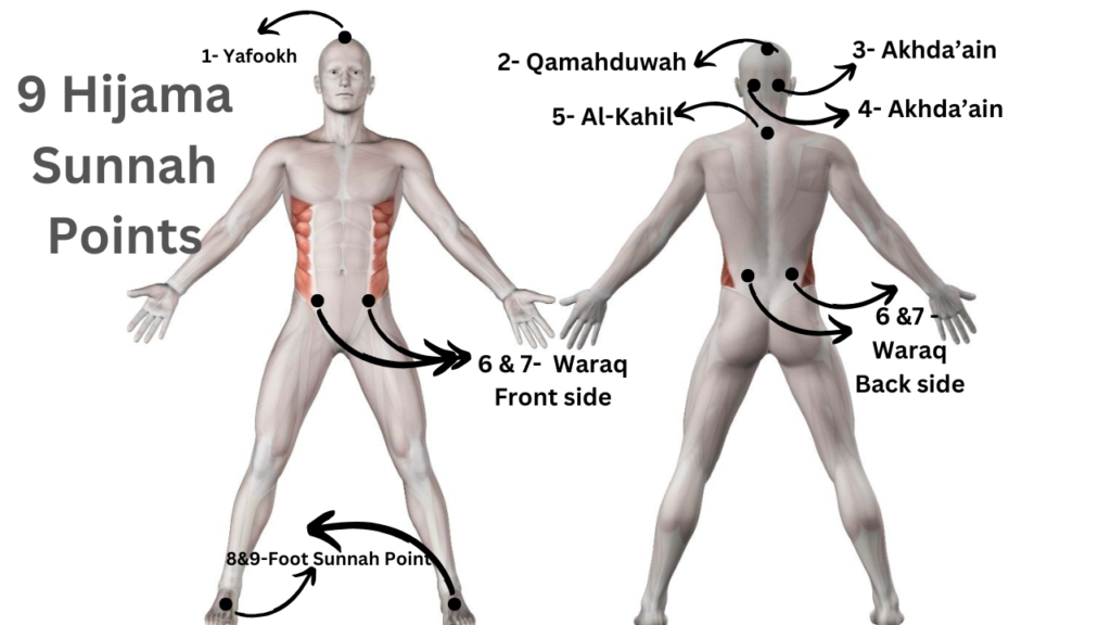 9 hijama sunnah points