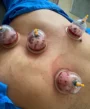 Hijamapoints at the back