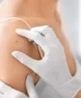 lipoma
