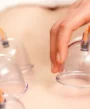 skin after hijama