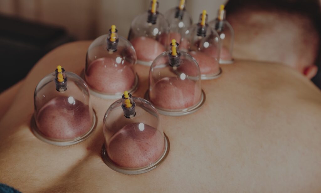 Hijama therapy may offer supportive benefits through several possible mechanisms.