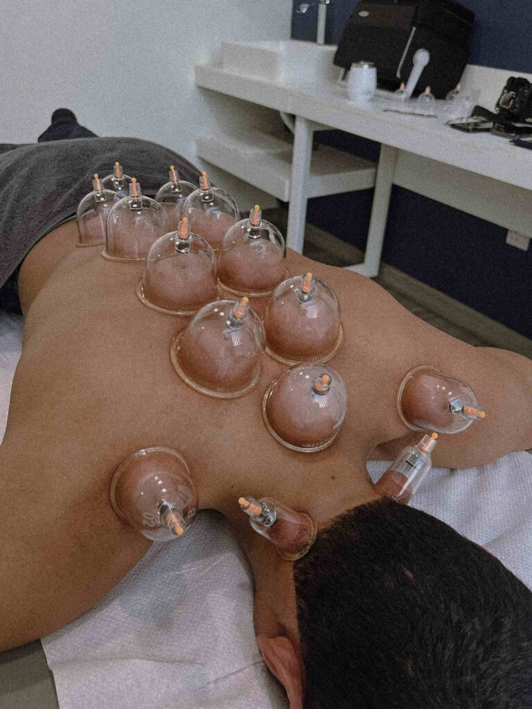 Hijama therapy Support for Inflammation Relief