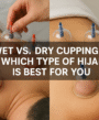 wet vs dry cupping and find which Hijama therapy fits your needs.