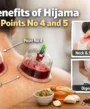 Benefits of Hijama Points no 4 and 5