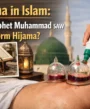 Hijama in Islam: Did Prophet Muhammad SAW Perform Hijama?