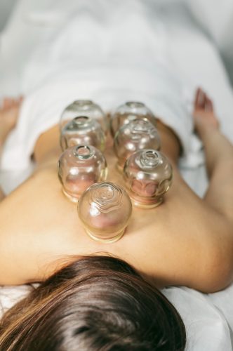 WET CUPPING THERAPY